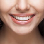 Closeup of a woman with a beautiful, white, straight smile